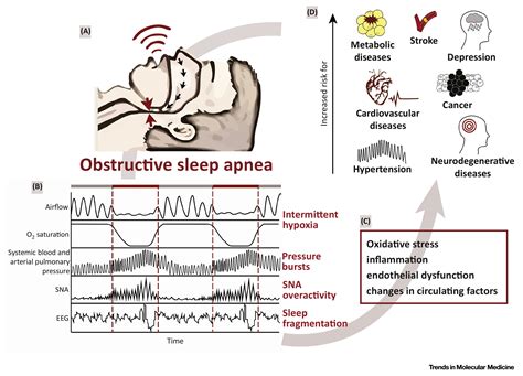 sleep apnea po polsku|The Epidemiology of Obstructive Sleep Apnea in .